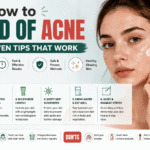 How to Get Rid of Acne Fast: Proven Tips That Work
